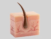 Dermatología